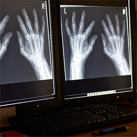 Radiografía de las manos de un paciente